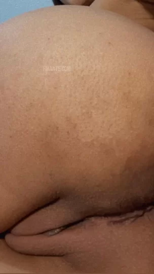 Imagem ou Vídeo