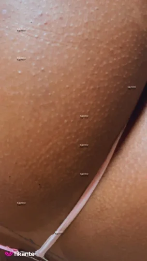 Imagem ou Vídeo
